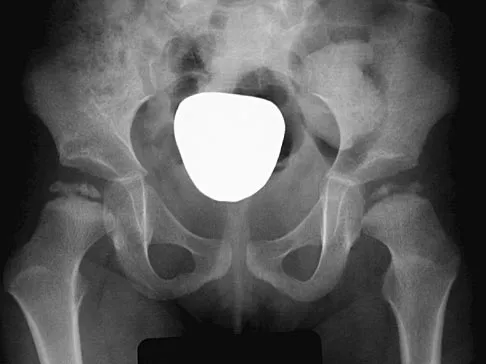 Orthopedic Surgery Board Review 2026 | High-Yield MCQs - Set 2 - Figure 77