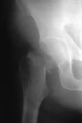 Orthopedic Surgery Board Review 2026 | High-Yield MCQs - Set 2 - Figure 82