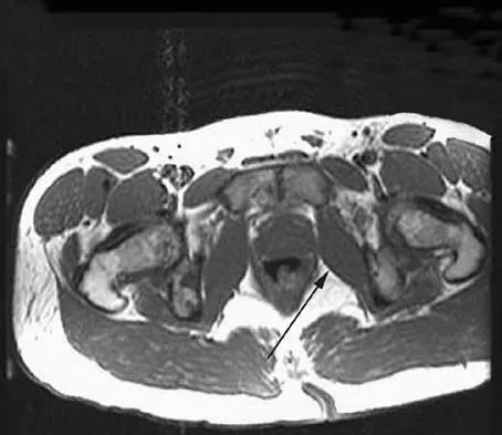 Orthopedic Surgery Board Review 2026 | High-Yield MCQs - Set 2 - Figure 88