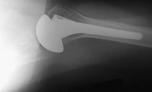 Orthopedic Surgery Board Review 2026 | High-Yield MCQs - Set 2 - Figure 91