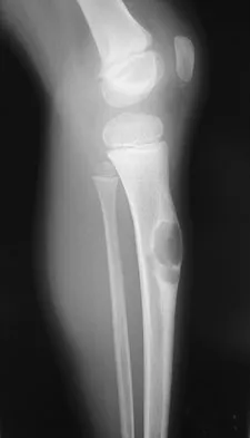 Orthopedic Surgery Board Review 2026 | High-Yield MCQs - Set 2 - Figure 97