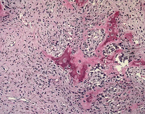 Orthopedic Surgery Board Review 2026 | High-Yield MCQs - Set 2 - Figure 98