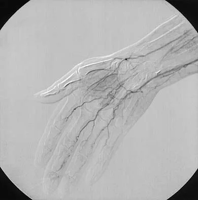 Orthopedic Surgery Board Review 2026 | High-Yield MCQs - Set 3 - Figure 103
