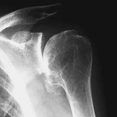 Orthopedic Surgery Board Review 2026 | High-Yield MCQs - Set 3 - Figure 107