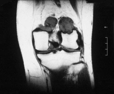 Orthopedic Surgery Board Review 2026 | High-Yield MCQs - Set 3 - Figure 12