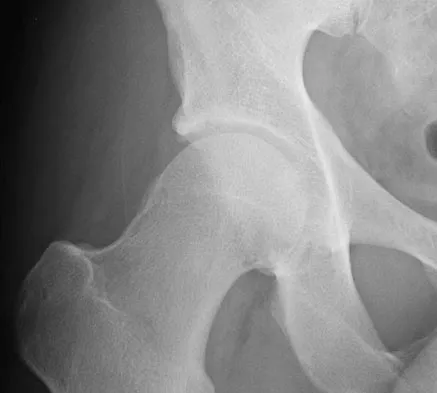 Orthopedic Surgery Board Review 2026 | High-Yield MCQs - Set 3 - Figure 14