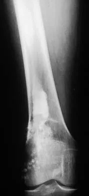 Orthopedic Surgery Board Review 2026 | High-Yield MCQs - Set 3 - Figure 15