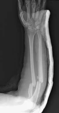 Orthopedic Surgery Board Review 2026 | High-Yield MCQs - Set 3 - Figure 19