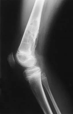 Orthopedic Surgery Board Review 2026 | High-Yield MCQs - Set 3 - Figure 21