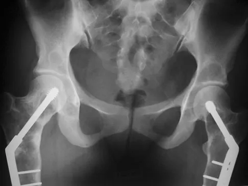 Orthopedic Surgery Board Review 2026 | High-Yield MCQs - Set 3 - Figure 25