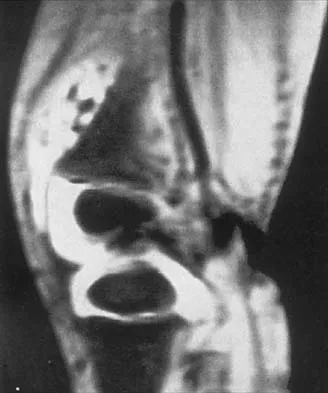 Orthopedic Surgery Board Review 2026 | High-Yield MCQs - Set 3 - Figure 36