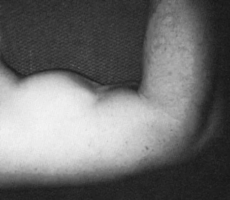 Orthopedic Surgery Board Review 2026 | High-Yield MCQs - Set 3 - Figure 39