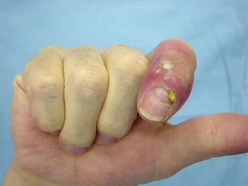 Orthopedic Surgery Board Review 2026 | High-Yield MCQs - Set 3 - Figure 50