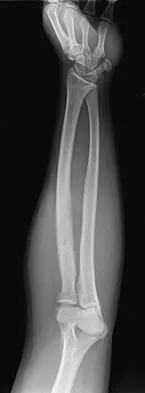 Orthopedic Surgery Board Review 2026 | High-Yield MCQs - Set 3 - Figure 75