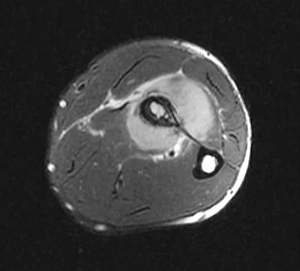 Orthopedic Surgery Board Review 2026 | High-Yield MCQs - Set 3 - Figure 79
