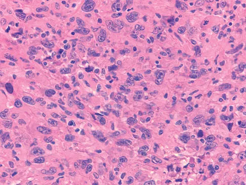 Orthopedic Surgery Board Review 2026 | High-Yield MCQs - Set 3 - Figure 86