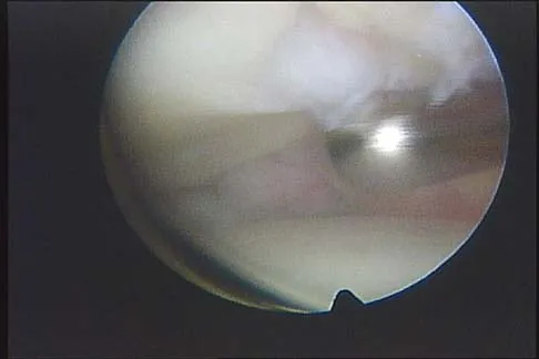 Orthopedic Surgery Board Review 2026 | High-Yield MCQs - Set 3 - Figure 89