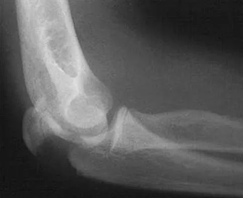 Orthopedic Surgery Board Review 2026 | High-Yield MCQs - Set 3 - Figure 91