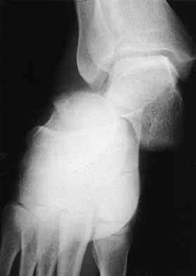 Orthopedic Surgery Board Review 2026 | High-Yield MCQs - Set 3 - Figure 97