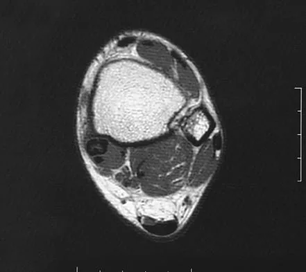 Orthopedic Surgery Board Review 2026 | High-Yield MCQs - Set 4 - Figure 101