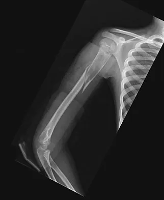 Orthopedic Surgery Board Review 2026 | High-Yield MCQs - Set 4 - Figure 113