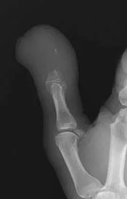 Orthopedic Surgery Board Review 2026 | High-Yield MCQs - Set 4 - Figure 17