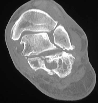 Orthopedic Surgery Board Review 2026 | High-Yield MCQs - Set 4 - Figure 22