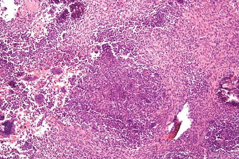 Orthopedic Surgery Board Review 2026 | High-Yield MCQs - Set 4 - Figure 37