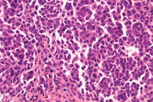 Orthopedic Surgery Board Review 2026 | High-Yield MCQs - Set 4 - Figure 38