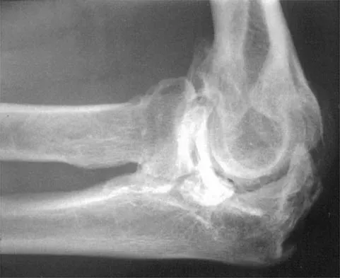 Orthopedic Surgery Board Review 2026 | High-Yield MCQs - Set 4 - Figure 46