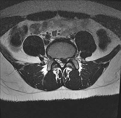 Orthopedic Surgery Board Review 2026 | High-Yield MCQs - Set 4 - Figure 54