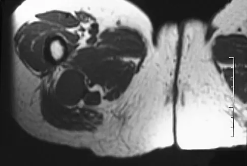Orthopedic Surgery Board Review 2026 | High-Yield MCQs - Set 4 - Figure 66