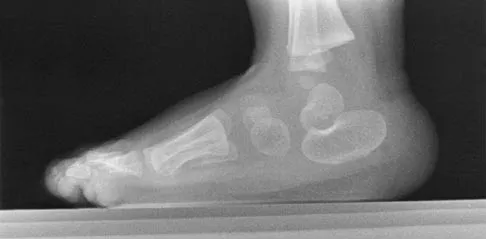 Orthopedic Surgery Board Review 2026 | High-Yield MCQs - Set 4 - Figure 89