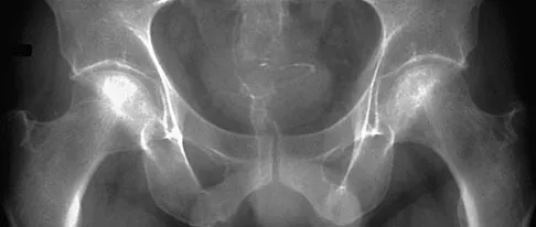 Orthopedic Surgery Board Review 2026 | High-Yield MCQs - Set 4 - Figure 92