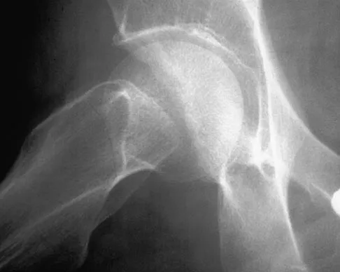 Orthopedic Surgery Board Review 2026 | High-Yield MCQs - Set 4 - Figure 93