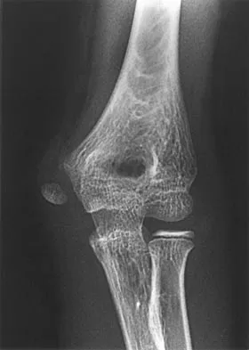 Orthopedic Surgery Board Review 2026 | High-Yield MCQs - Set 4 - Figure 99