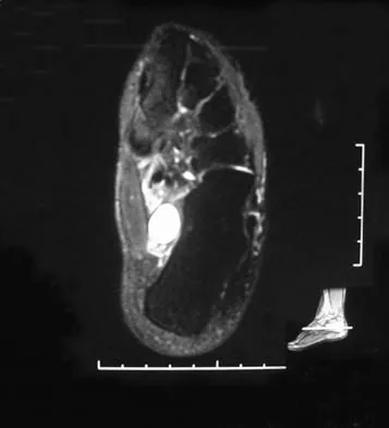 Orthopedic Surgery Board Review 2026 | High-Yield MCQs - Set 5 - Figure 10