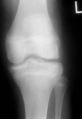 Orthopedic Surgery Board Review 2026 | High-Yield MCQs - Set 5 - Figure 107