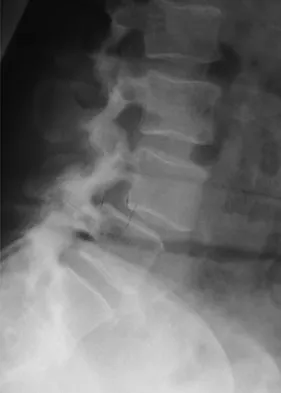 Orthopedic Surgery Board Review 2026 | High-Yield MCQs - Set 5 - Figure 111