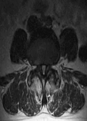 Orthopedic Surgery Board Review 2026 | High-Yield MCQs - Set 5 - Figure 112