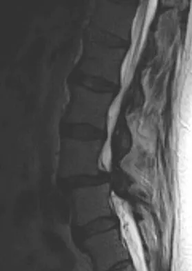 Orthopedic Surgery Board Review 2026 | High-Yield MCQs - Set 5 - Figure 113