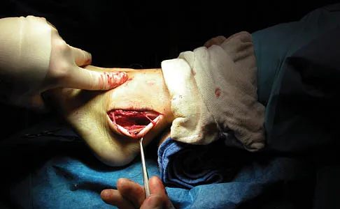 Orthopedic Surgery Board Review 2026 | High-Yield MCQs - Set 5 - Figure 114