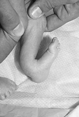 Orthopedic Surgery Board Review 2026 | High-Yield MCQs - Set 5 - Figure 115