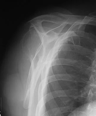 Orthopedic Surgery Board Review 2026 | High-Yield MCQs - Set 5 - Figure 13