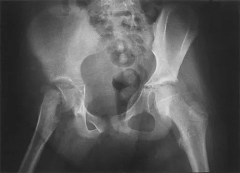 Orthopedic Surgery Board Review 2026 | High-Yield MCQs - Set 5 - Figure 14