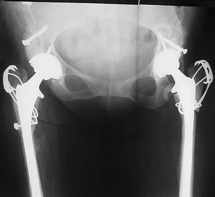 Orthopedic Surgery Board Review 2026 | High-Yield MCQs - Set 5 - Figure 16