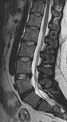 Orthopedic Surgery Board Review 2026 | High-Yield MCQs - Set 5 - Figure 19