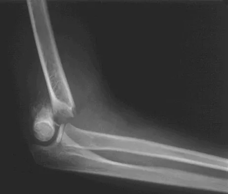 Orthopedic Surgery Board Review 2026 | High-Yield MCQs - Set 5 - Figure 21