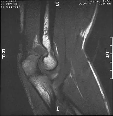 Orthopedic Surgery Board Review 2026 | High-Yield MCQs - Set 5 - Figure 3