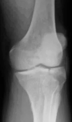 Orthopedic Surgery Board Review 2026 | High-Yield MCQs - Set 5 - Figure 4